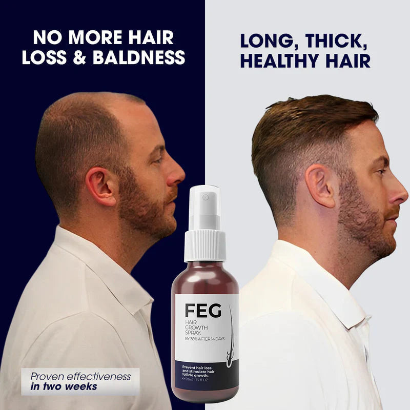 Original USA FEG Plus Hair Growth Spray ( 50 ML )