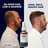 Original USA FEG Plus Hair Growth Spray ( 50 ML )
