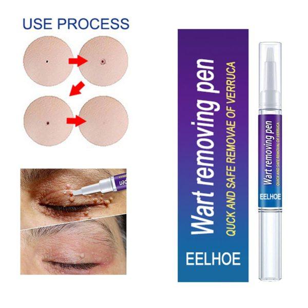 Wart Remover Gel Pen Fast & Effective
