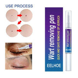 Wart Remover Gel Pen Fast & Effective